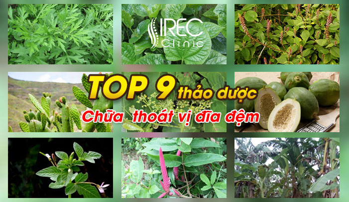 Thuốc đông y chữa thoát vị đĩa đệm